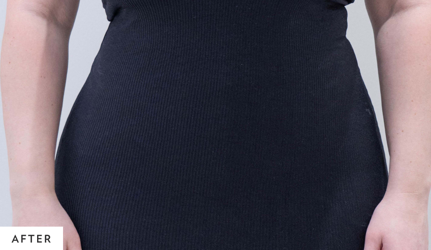 after_lipo_homepage