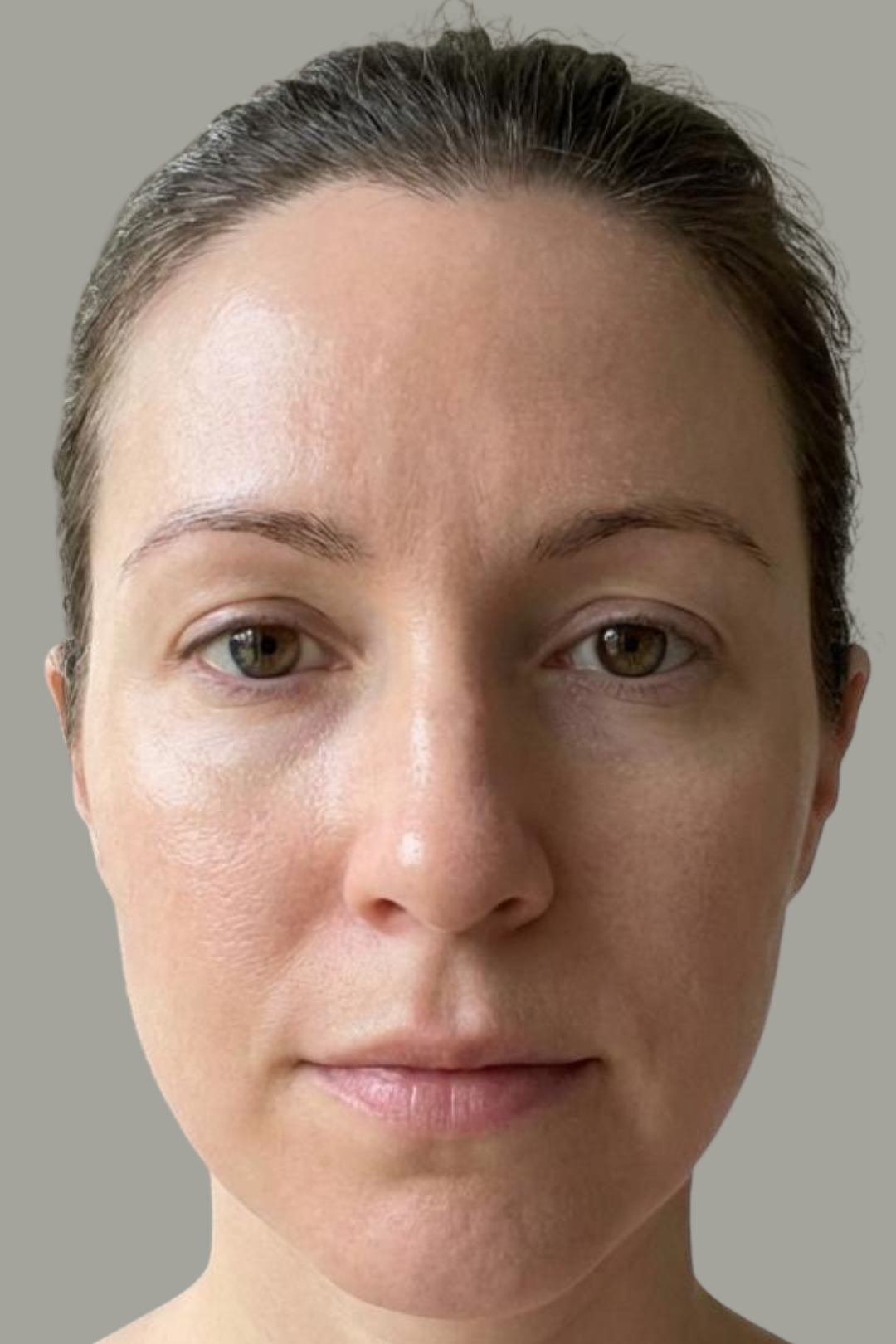 The Vitch Dermal Reset 5 106