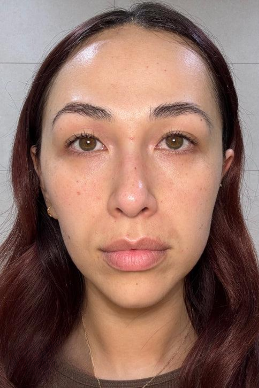 The Vitch Dermal Reset 6 107