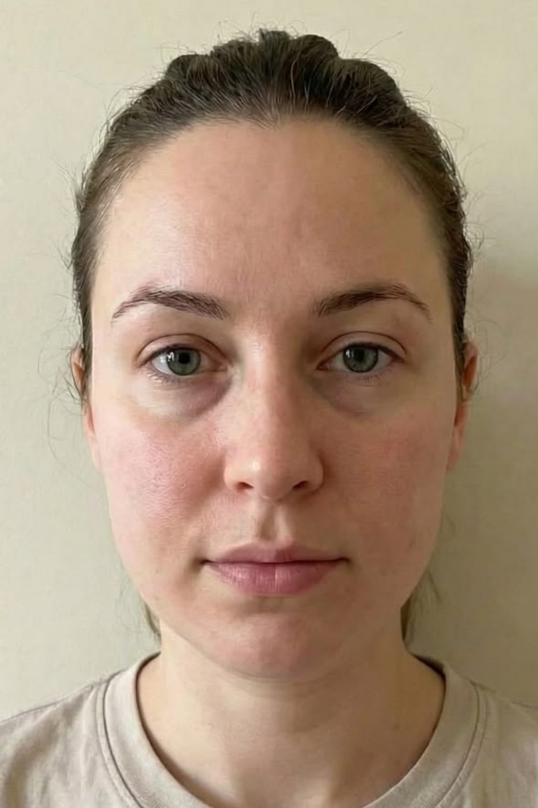 The Anatomical Body Resurfacing 6 51