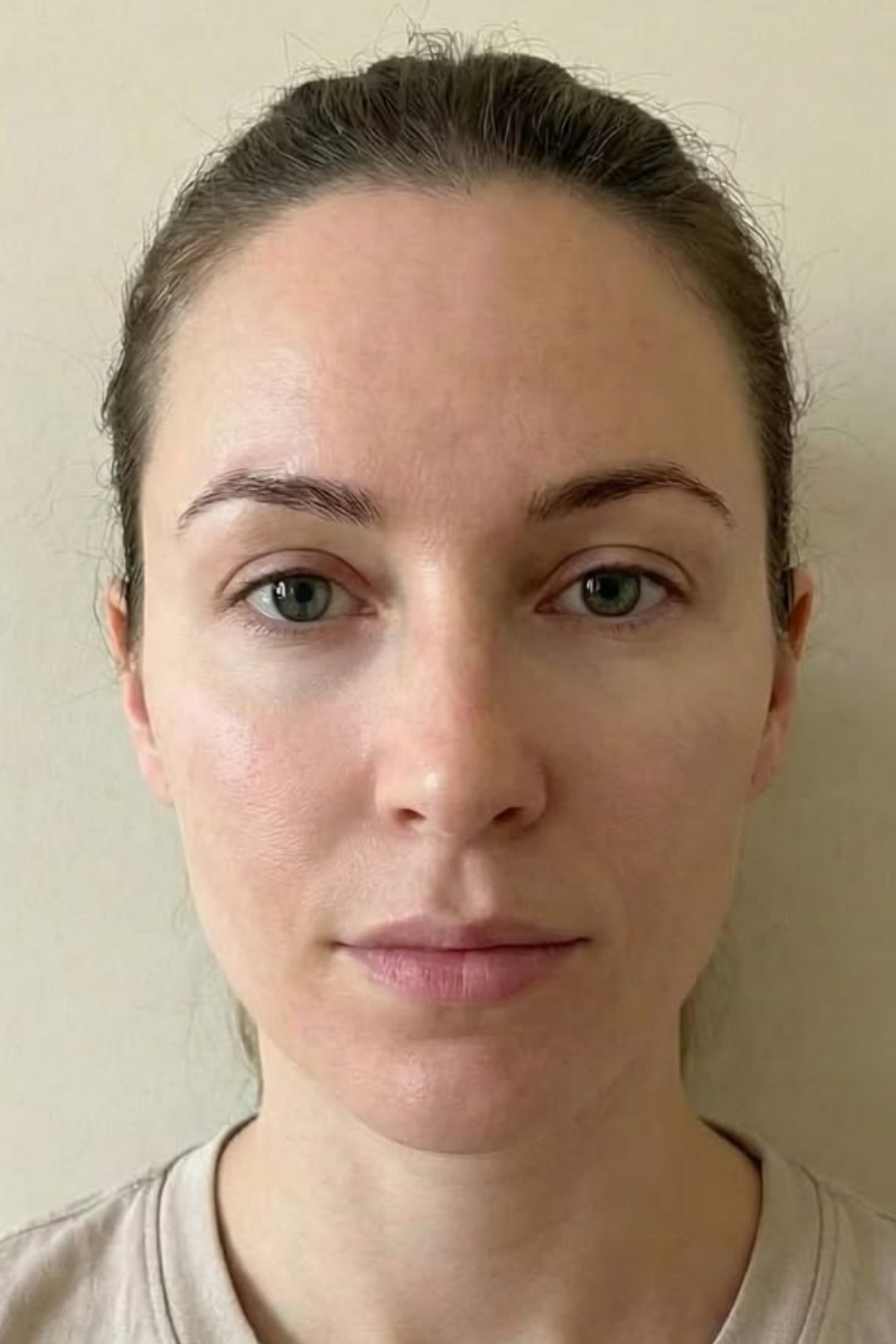 The Anatomical Body Resurfacing 7 52
