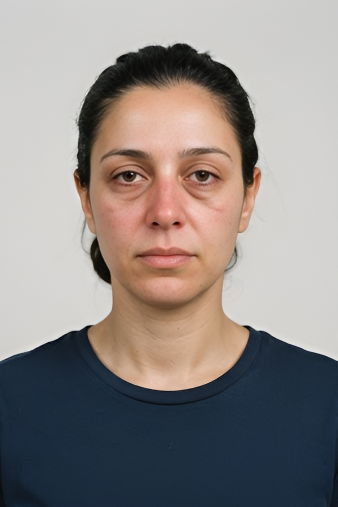 Vitch treatment result