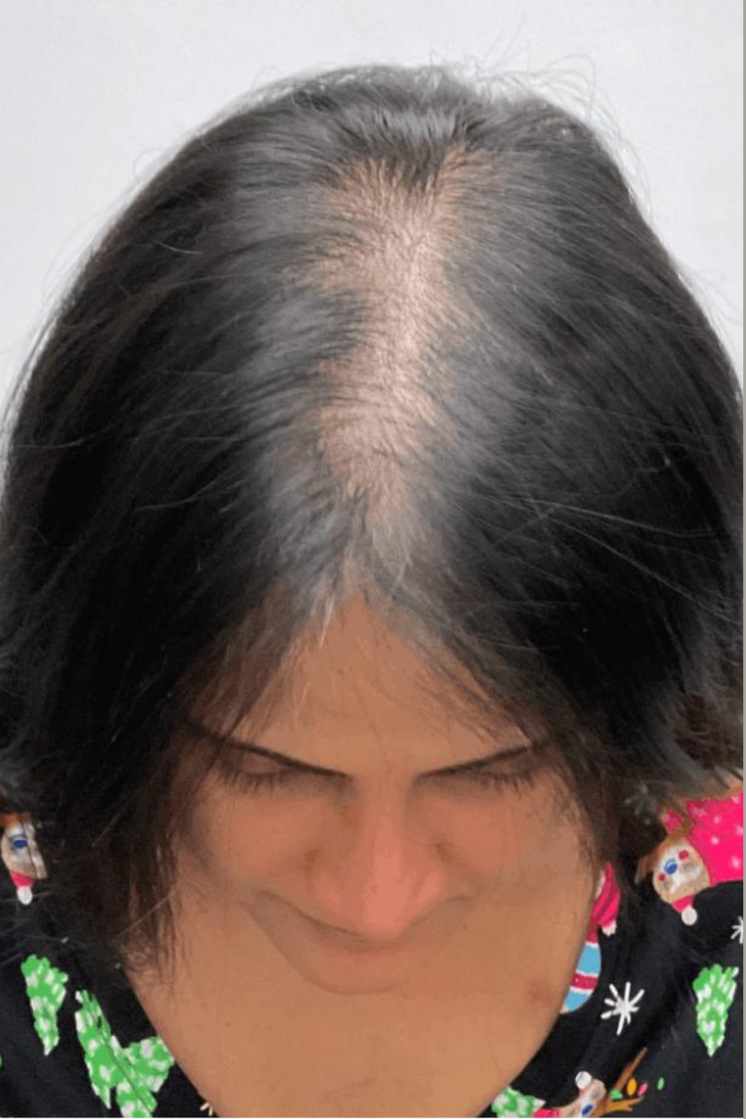 Follicular Bio-Signaling 4 91