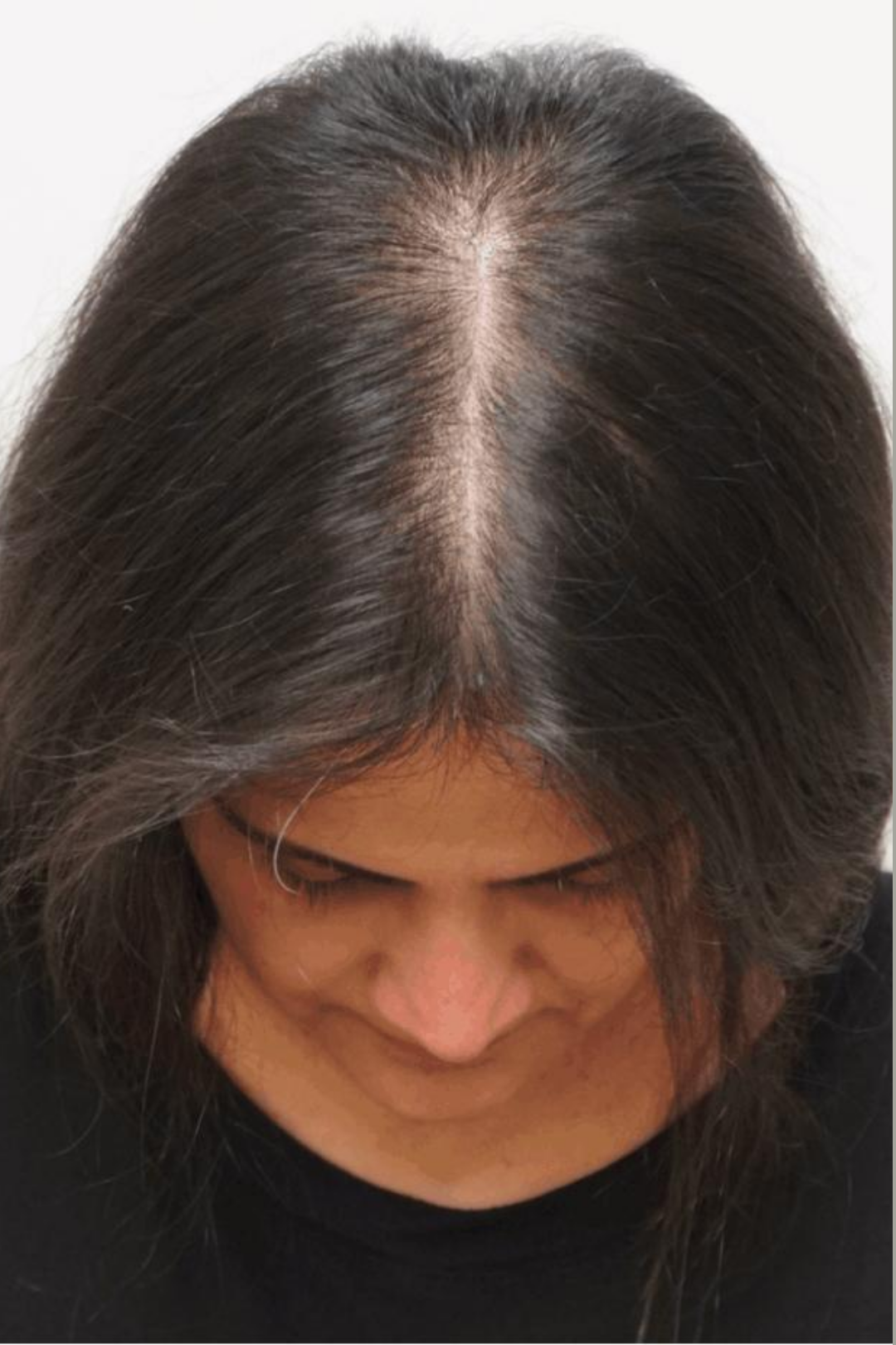 Follicular Bio-Signaling 5 92