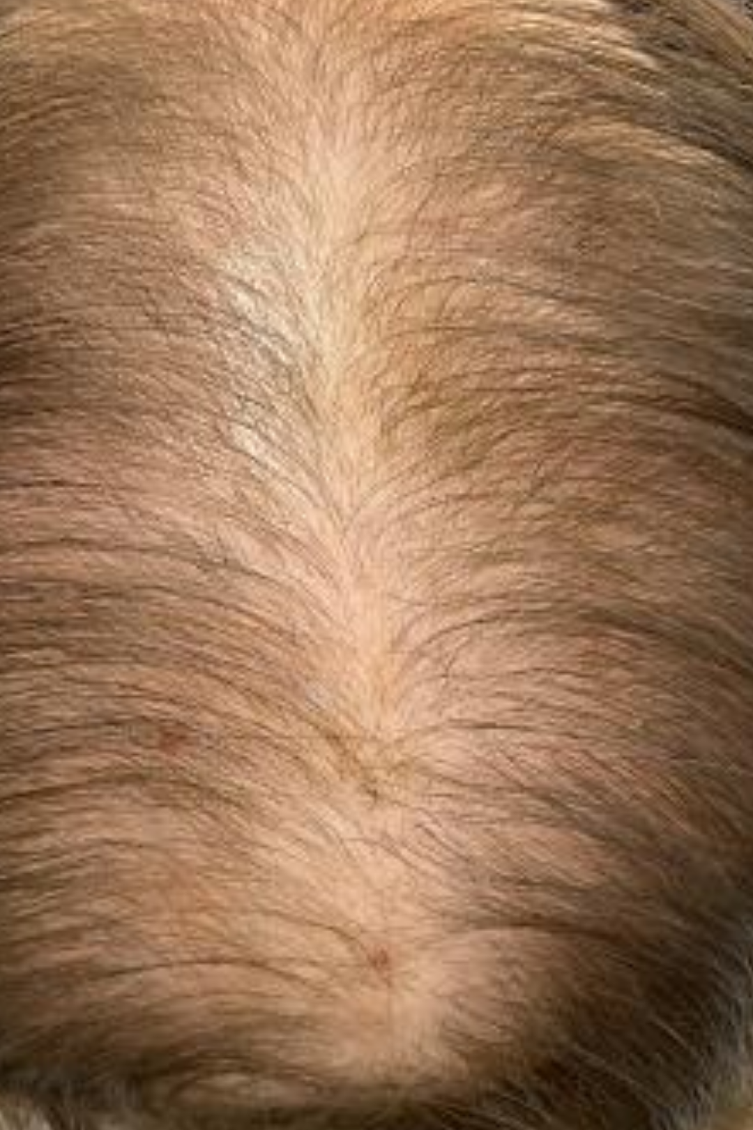 Follicular Bio-Signaling 6 93