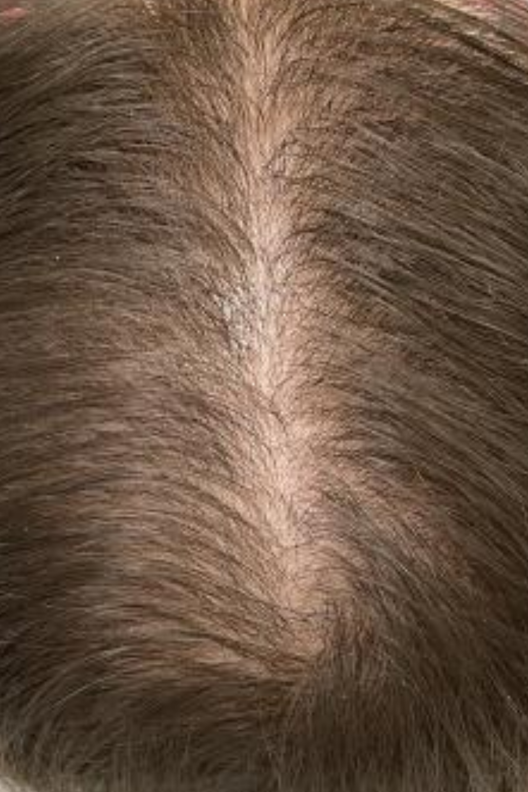 Follicular Bio-Signaling 7 94