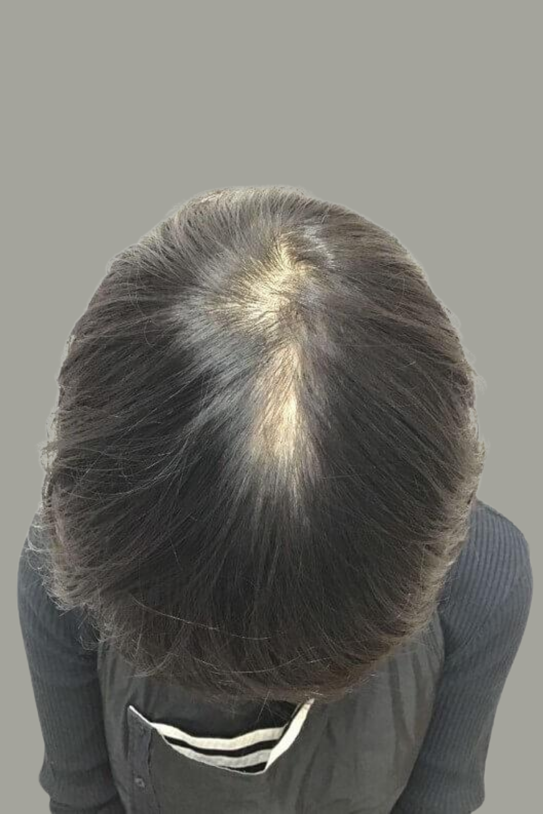 Follicular Bio-Signaling 8 95