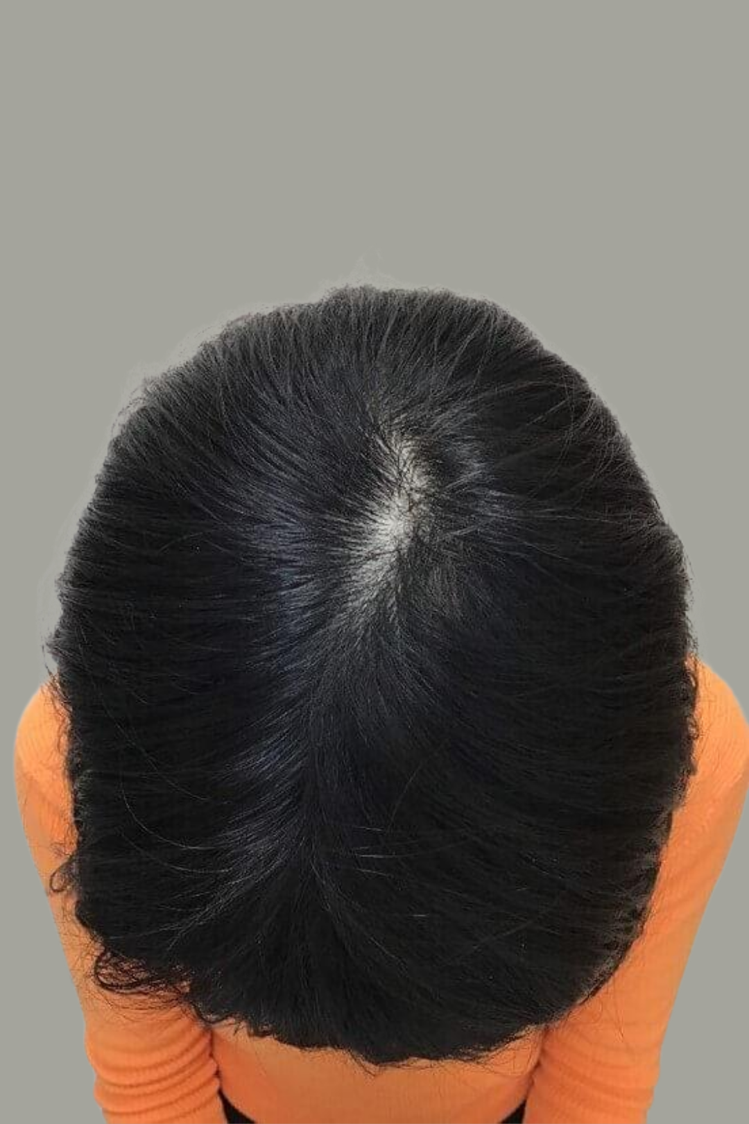 Follicular Bio-Signaling 9 96
