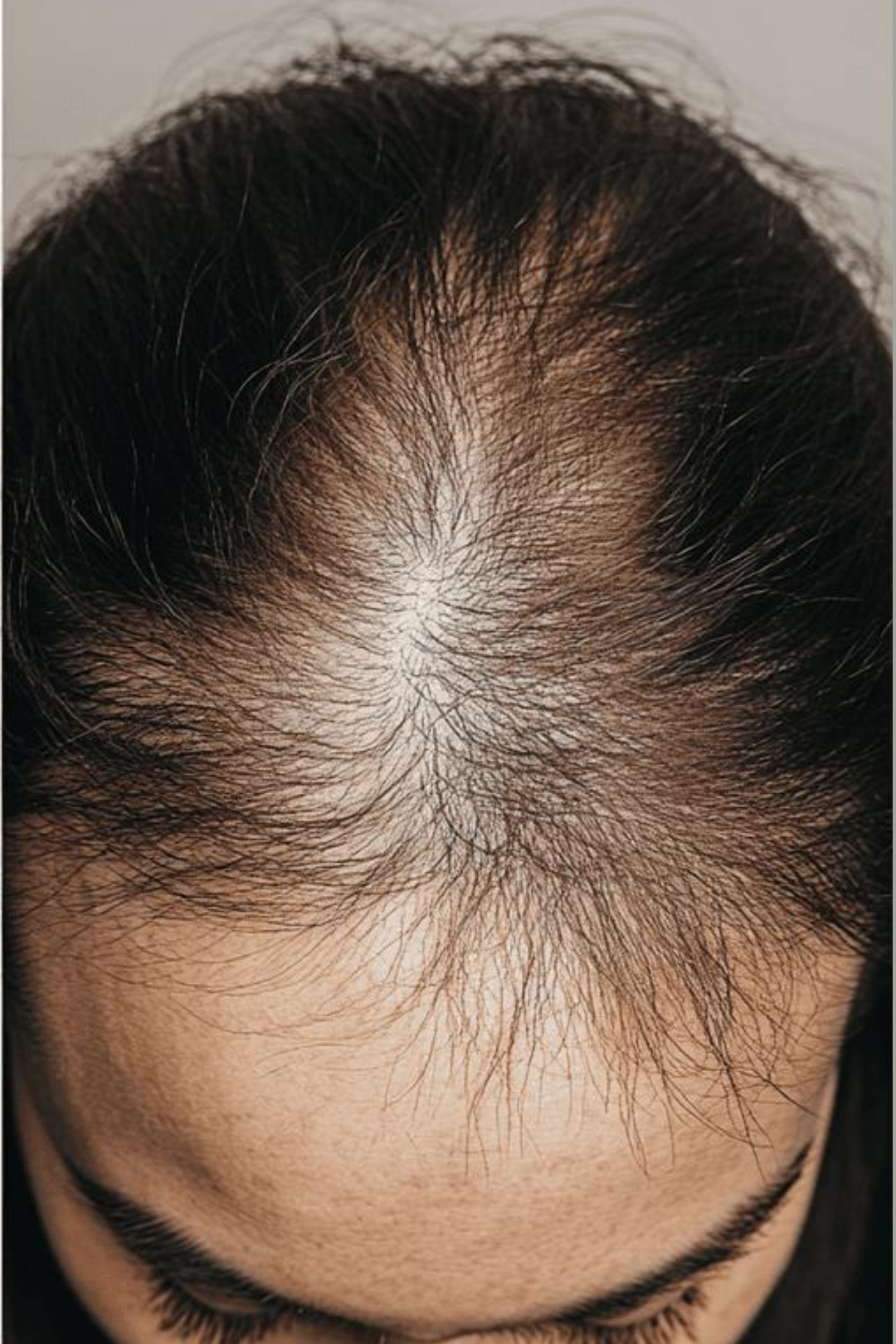 Follicular Bio-Signaling 10 97