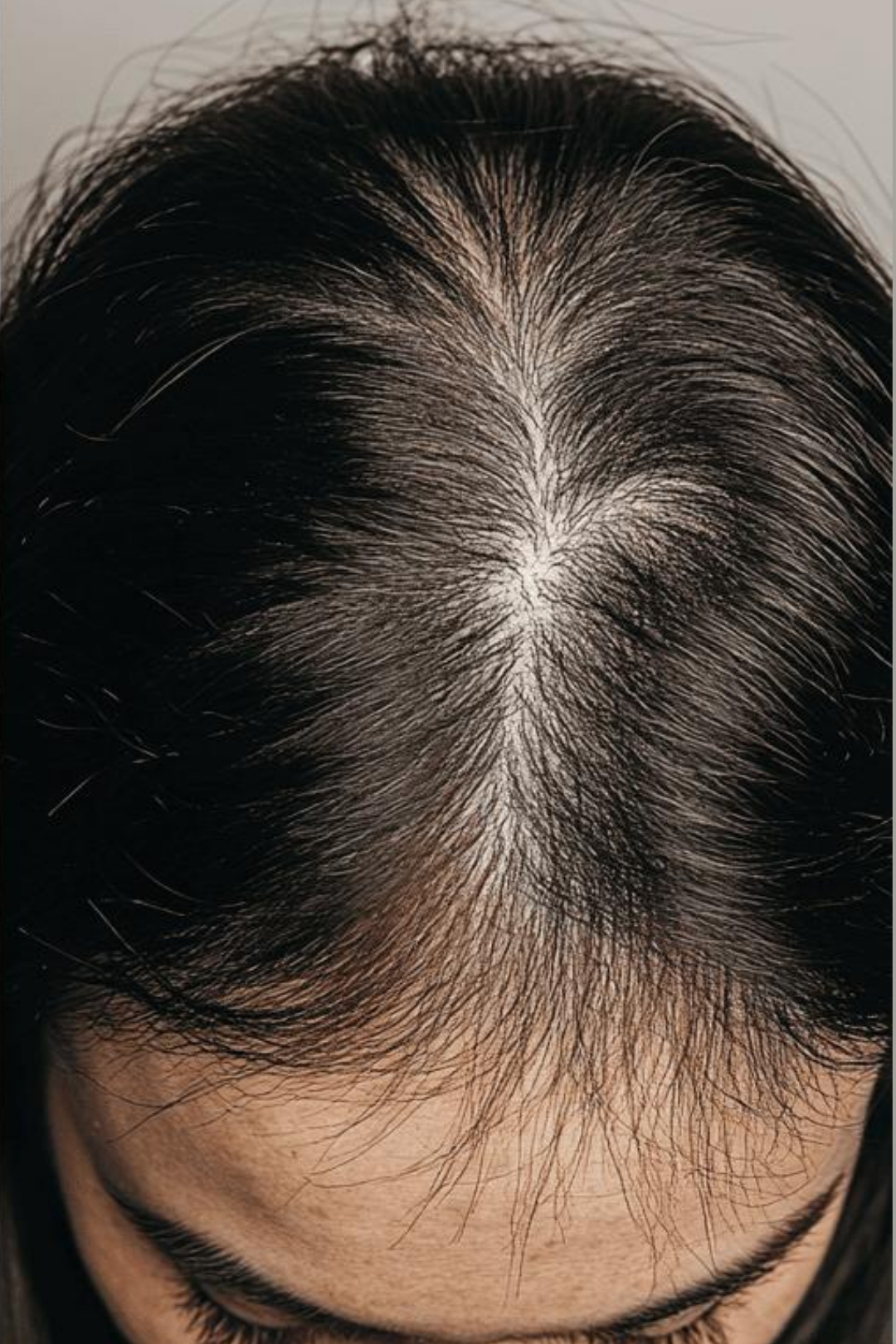 Follicular Bio-Signaling 11 98