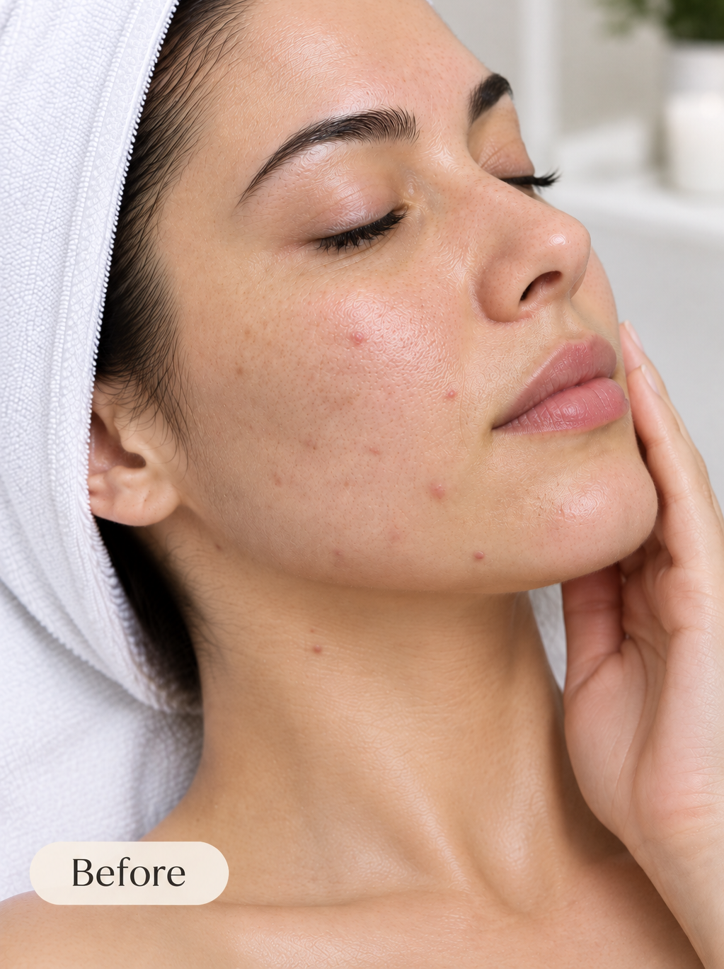 SKIN REJUVENATION 14 ChatGPT Image Sep 17, 2026, 01_06_55 AM