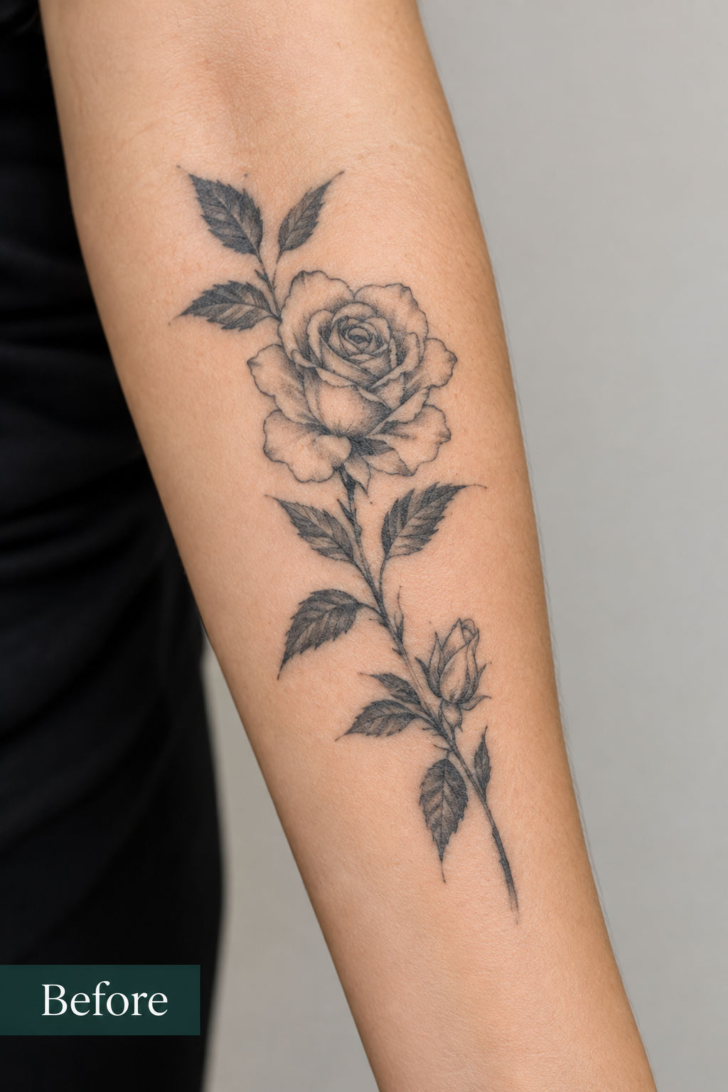 Photomechanical Correction (Pico Laser & Tattoos) 5 ChatGPT Image Sep 21 2026 11 47 52 PM