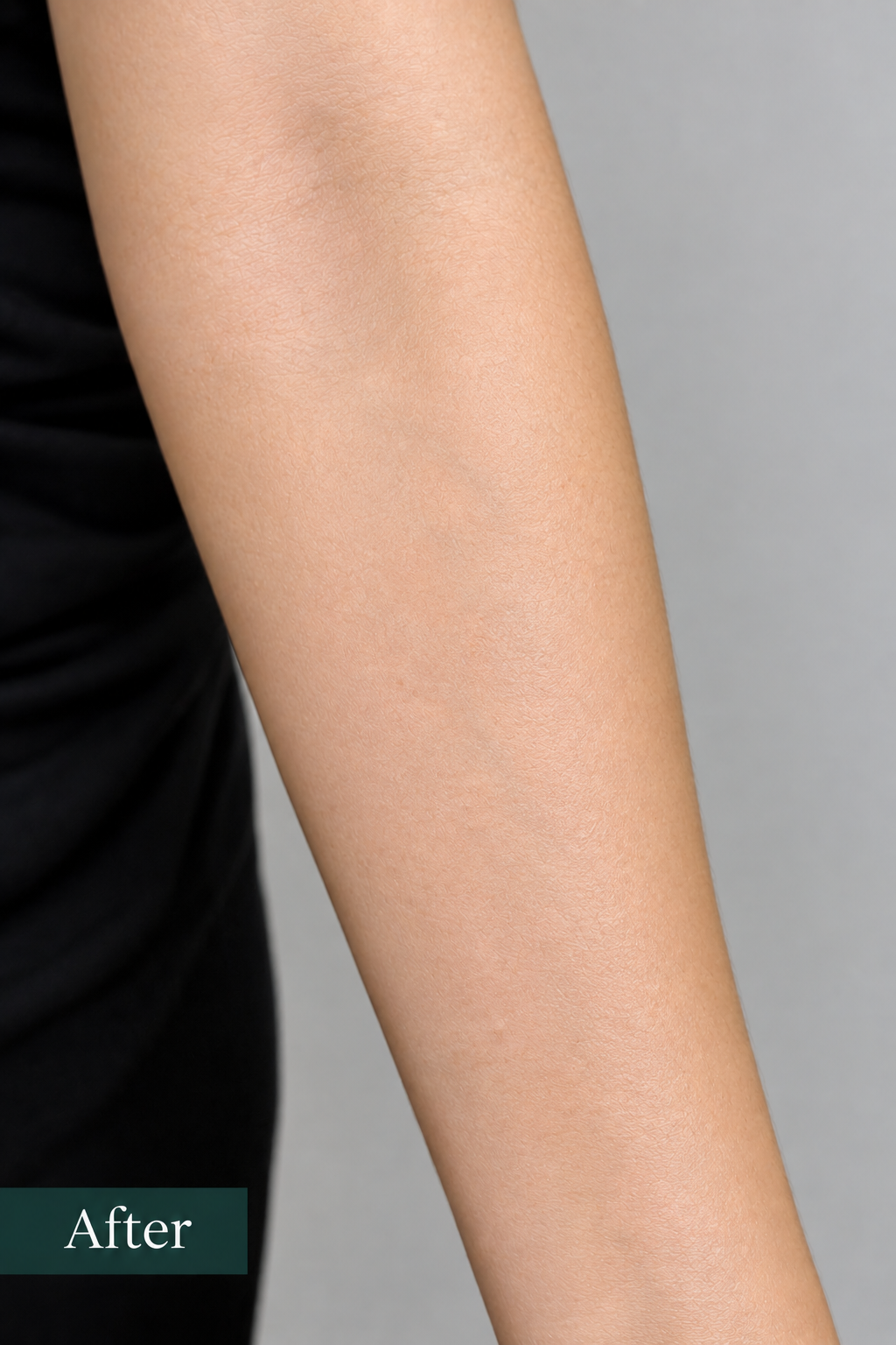 Photomechanical Correction (Pico Laser & Tattoos) 4 ChatGPT Image Sep 21 2026 11 49 03 PM